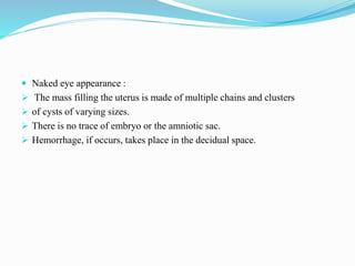  Naked eye appearance :
 The mass filling the uterus is made of multiple chains and clusters
 of cysts of varying sizes.
 There is no trace of embryo or the amniotic sac.
 Hemorrhage, if occurs, takes place in the decidual space.
 