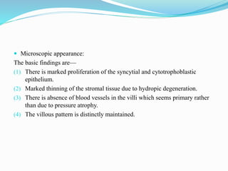 Microscopic appearance:
The basic findings are—
(1) There is marked proliferation of the syncytial and cytotrophoblastic
epithelium.
(2) Marked thinning of the stromal tissue due to hydropic degeneration.
(3) There is absence of blood vessels in the villi which seems primary rather
than due to pressure atrophy.
(4) The villous pattern is distinctly maintained.
 