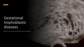 Molar pregnancy .pptx