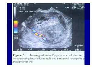 1919--SepSep--1212 o wardao warda
 