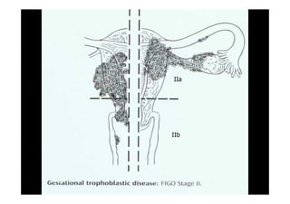 IIa
IIb
1919--SepSep--1212 o wardao warda
 