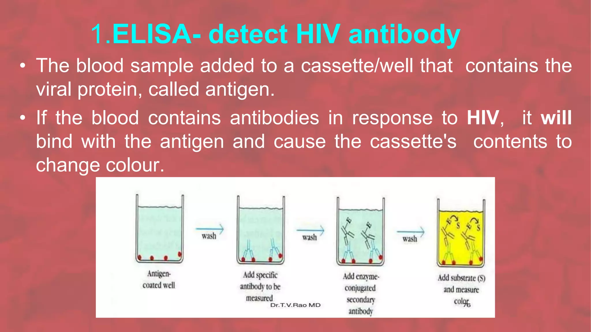 1.ELISA- detect HIV antibody
• The blood sample added to a cassette/well that contains the
viral protein, called antigen.
• If the blood contains antibodies in response to HIV, it will
bind with the antigen and cause the cassette's contents to
change colour.
 