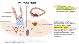 Pstt Gestational trophoblastic disorders (gtd) | PPTX