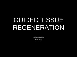 GUIDED TISSUE
REGENERATION
K.NARENDHIRAN
MDS I Year
 