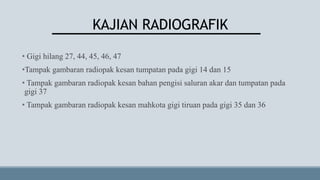 KAJIAN RADIOGRAFIK
• Gigi hilang 27, 44, 45, 46, 47
•Tampak gambaran radiopak kesan tumpatan pada gigi 14 dan 15
• Tampak gambaran radiopak kesan bahan pengisi saluran akar dan tumpatan pada
gigi 37
• Tampak gambaran radiopak kesan mahkota gigi tiruan pada gigi 35 dan 36
 