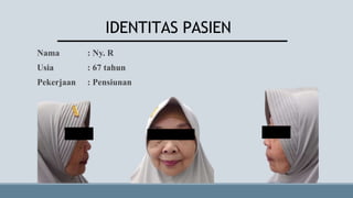 Nama : Ny. R
Usia : 67 tahun
Pekerjaan : Pensiunan
IDENTITAS PASIEN
 