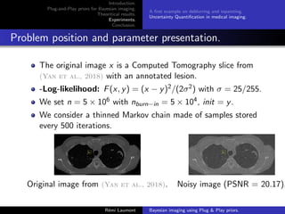Introduction.
Plug-and-Play priors for Bayesian imaging.
Theoritical results.
Experiments.
Conclusion.
A first example on deblurring and inpainting.
Uncertainty Quantification in medical imaging.
Problem position and parameter presentation.
The original image x is a Computed Tomography slice from
(Yan et al., 2018) with an annotated lesion.
-Log-likelihood: F(x, y) = (x − y)2/(2σ2) with σ = 25/255.
We set n = 5 × 106 with nburn−in = 5 × 104, init = y.
We consider a thinned Markov chain made of samples stored
every 500 iterations.
Original image from (Yan et al., 2018). Noisy image (PSNR = 20.17).
Rémi Laumont Bayesian imaging using Plug  Play priors.
 