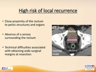 High risk of local recurrence
• Close proximity of the rectum
to pelvic structures and organs
• Absence of a serosa
surrounding the rectum
• Technical difficulties associated
with obtaining wide surgical
margins at resection.
 
