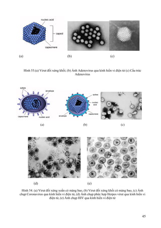 (a) (b) (c)
Hình 53.(a) Virut đối xứng khối; (b) Ảnh Adenovirus qua kính hiển vi điện tử (c) Cấu trúc
Adenovirus
(a) (b) (c)
(d) (e)
Hình 54. (a) Virut đối xứng xoắn có màng bao, (b) Virut đối xứng khối có màng bao, (c) Ảnh
chụp Coronavirus qua kính hiển vi điện tử, (d) Ảnh chụp phức hợp Herpes virut qua kính hiển vi
điện tử, (e) Ảnh chụp HIV qua kính hiển vi điện tử
45
 