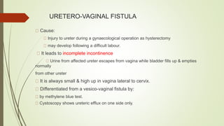 URETERO-VAGINAL FISTULA
Cause:
Injury to ureter during a gynaecological operation as hysterectomy
may develop following a difficult labour.
It leads to incomplete incontinence
Urine from affected ureter escapes from vagina while bladder fills up & empties
normally
from other ureter
It is always small & high up in vagina lateral to cervix.
Differentiated from a vesico-vaginal fistula by:
by methylene blue test.
Cystoscopy shows ureteric efflux on one side only.
 