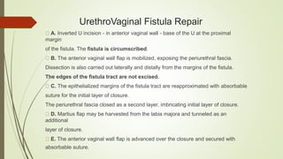 UrethroVaginal Fistula Repair
A. Inverted U incision - in anterior vaginal wall - base of the U at the proximal
margin
of the fistula. The fistula is circumscribed.
B. The anterior vaginal wall flap is mobilized, exposing the periurethral fascia.
Dissection is also carried out laterally and distally from the margins of the fistula.
The edges of the fistula tract are not excised.
C. The epithelialized margins of the fistula tract are reapproximated with absorbable
suture for the initial layer of closure.
The periurethral fascia closed as a second layer, imbricating initial layer of closure.
D. Martius flap may be harvested from the labia majora and tunneled as an
additional
layer of closure.
E. The anterior vaginal wall flap is advanced over the closure and secured with
absorbable suture.
 