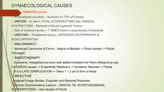 GYNAECOLOGICAL CAUSES
OPERATIVE injuries
In Developed countries – accounts for 70% of Fistulas
URETER – At risk in TOTAL HYSTERECTOMY esp, RADICAL
HYSTRECTOMY , Removal of Broad Ligament Tumors
Risk of Ureteral Injuries – 7 TIMES more in Laparoscopic Procedures
URETHRA – Threatened during – ANTERIOR COLPORRAPHY &
SLING OPERATION
MALIGNANCY -
Advanced Carcinoma of Cervix , Vagina or Bladder -> Direct spread -> Fistula
FOrmation
RADIOTHERAPY
Excessive, misapplied and even well apllied irradiation for Pelvic Malignancy esp,
CA CERVIX causes -> Endarteritis Obliterans -> Ischaemic Necrosis -> Fistula
It is a LATE COMPLICATION -> Takes 1 – 2 yrs to form a fistula
INFECTIVE
Vaginal Foreign Bodies, Forgotten and Retained Pessaries
Chronic Granulomatous Lesions – GENITAL TB, SCHISTOSOMIASIS,
ACTINOMYCOSIS – rare causes of Fistula
 