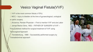 Vesico Vaginal Fistula(VVF)
VVF is the most common fistula (>75%)
MCC – injury to bladder at the time of gynaecological, urological
or pelvic surgery.
Avicenna, Persian Physician – First to mention VVF and a/w Labor
James Marion Sims, 1852 – FATHER OF SURGERY of VVF –
First published method for surgical treatment of VVF using
Transvaginal Approach
Trendelenburg , 1888 – Successfully performed surgery by
Transabdominal approach
 