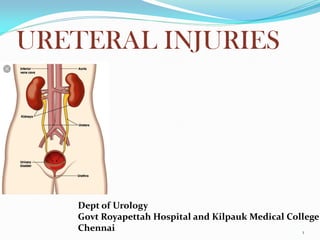 URETERAL INJURIES
Dept of Urology
Govt Royapettah Hospital and Kilpauk Medical College
Chennai 1
 