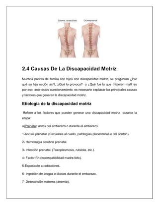 2.4 Causas De La Discapacidad Motriz
Muchos padres de familia con hijos con discapacidad motriz, se preguntan ¿Por
qué su hijo nación así?, ¿Qué lo provoco? o ¿Qué fue lo que hicieron mal? es
por eso ante estos cuestionamiento, es necesario expliacar las principales causas
y factores que generen la discapacidad motriz.
Etiología de la discapacidad motriz
Refiere a los factores que pueden generar una discapacidad motriz durante la
etapa:
a)Prenatal: antes del embarazo o durante el embarazo.
1-Anoxia prenatal. (Circulares al cuello, patologías placentarias o del cordón).
2- Hemorragia cerebral prenatal.
3- Infección prenatal. (Toxoplasmosis, rubéola, etc.).
4- Factor Rh (incompatibilidad madre-feto).
5-Exposición a radiaciones.
6- Ingestión de drogas o tóxicos durante el embarazo.
7- Desnutrición materna (anemia).
 