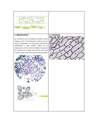 3. AMILOPLASTOS
Así se observa con un aumento de 100X. En esta
imagen se ven los amiloplastos sueltos ya que al
raspar se rompieron las células que contienen los
amiloplastos y estos quedan sueltos en el
preparado.La coloración azul sedebe a la reacción
del almidón con el lugol, que tiñe de este color
cuando se pone en presencia de este polisacárido.
4.- VACUOLAS
 