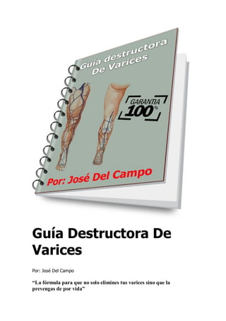Guía Destructora De
Varices
Por: José Del Campo
“La fórmula para que no solo elimines tus varices sino que la
prevengas de por vida”
 
