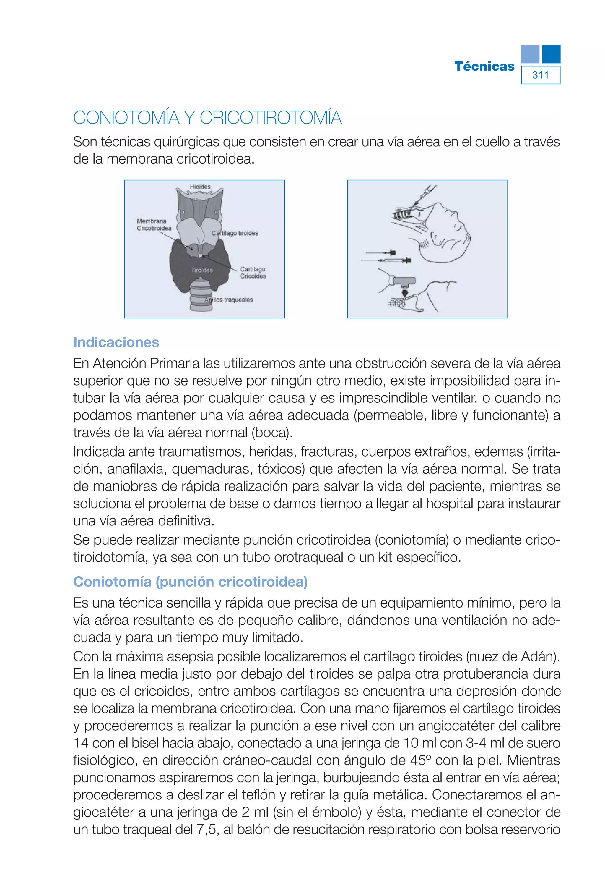 Maqueta V6.5.qxd   14/6/11   15:57   Página 311




                                                                            Técnicas
                                                                                          311



           CONIOTOMÍA Y CRICOTIROTOMÍA
           Son técnicas quirúrgicas que consisten en crear una vía aérea en el cuello a través
           de la membrana cricotiroidea.




           Indicaciones
           En Atención Primaria las utilizaremos ante una obstrucción severa de la vía aérea
           superior que no se resuelve por ningún otro medio, existe imposibilidad para in-
           tubar la vía aérea por cualquier causa y es imprescindible ventilar, o cuando no
           podamos mantener una vía aérea adecuada (permeable, libre y funcionante) a
           través de la vía aérea normal (boca).
           Indicada ante traumatismos, heridas, fracturas, cuerpos extraños, edemas (irrita-
           ción, anafilaxia, quemaduras, tóxicos) que afecten la vía aérea normal. Se trata
           de maniobras de rápida realización para salvar la vida del paciente, mientras se
           soluciona el problema de base o damos tiempo a llegar al hospital para instaurar
           una vía aérea definitiva.
           Se puede realizar mediante punción cricotiroidea (coniotomía) o mediante crico-
           tiroidotomía, ya sea con un tubo orotraqueal o un kit específico.
           Coniotomía (punción cricotiroidea)
           Es una técnica sencilla y rápida que precisa de un equipamiento mínimo, pero la
           vía aérea resultante es de pequeño calibre, dándonos una ventilación no ade-
           cuada y para un tiempo muy limitado.
           Con la máxima asepsia posible localizaremos el cartílago tiroides (nuez de Adán).
           En la línea media justo por debajo del tiroides se palpa otra protuberancia dura
           que es el cricoides, entre ambos cartílagos se encuentra una depresión donde
           se localiza la membrana cricotiroidea. Con una mano fijaremos el cartílago tiroides
           y procederemos a realizar la punción a ese nivel con un angiocatéter del calibre
           14 con el bisel hacia abajo, conectado a una jeringa de 10 ml con 3-4 ml de suero
           fisiológico, en dirección cráneo-caudal con ángulo de 45º con la piel. Mientras
           puncionamos aspiraremos con la jeringa, burbujeando ésta al entrar en vía aérea;
           procederemos a deslizar el teflón y retirar la guía metálica. Conectaremos el an-
           giocatéter a una jeringa de 2 ml (sin el émbolo) y ésta, mediante el conector de
           un tubo traqueal del 7,5, al balón de resucitación respiratorio con bolsa reservorio
 