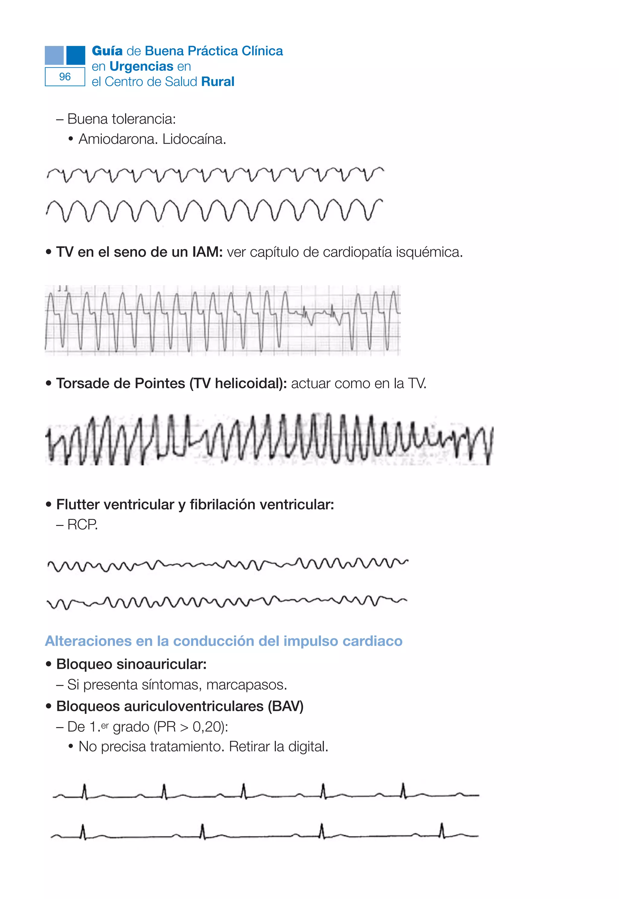 Maqueta V6.5.qxd   14/6/11   15:56   Página 96




              Guía de Buena Práctica Clínica
              en Urgencias en
        96
              el Centro de Salud Rural

        – Buena tolerancia:
          • Amiodarona. Lidocaína.




      • TV en el seno de un IAM: ver capítulo de cardiopatía isquémica.




      • Torsade de Pointes (TV helicoidal): actuar como en la TV.




      • Flutter ventricular y fibrilación ventricular:
        – RCP.




      Alteraciones en la conducción del impulso cardiaco
      • Bloqueo sinoauricular:
        – Si presenta síntomas, marcapasos.
      • Bloqueos auriculoventriculares (BAV)
        – De 1.er grado (PR > 0,20):
          • No precisa tratamiento. Retirar la digital.
 