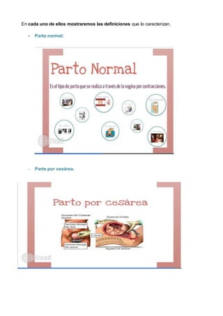 En cada uno de ellos mostraremos las definiciones que lo caracterizan.
- Parto normal:
- Parto por cesárea.
 