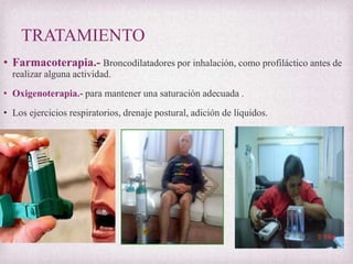 TRATAMIENTO
• Farmacoterapia.- Broncodilatadores por inhalación, como profiláctico antes de
realizar alguna actividad.

• Oxigenoterapia.- para mantener una saturación adecuada .
• Los ejercicios respiratorios, drenaje postural, adición de líquidos.

 