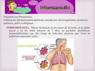 Estreptococos Pneumoniae.
Inflamación del parénquima pulmonar causada por microorganismos, productos
químicos, polvo o alérgenos.

EPIDEMIOLOGÍA.- Mayor incidencia en los meses de invierno, en el adulto
mayor y en los niños mayores de 5 años, en pacientes alcohólicos,
inmunodeficientes con alto riesgo de infección, personas que viven en
ambientes especiales asilos.
.

 