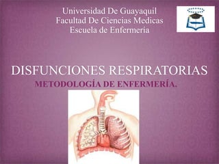 Universidad De Guayaquil
Facultad De Ciencias Medicas
Escuela de Enfermería

DISFUNCIONES RESPIRATORIAS
METODOLOGÍA DE ENFERMERÍA.

 