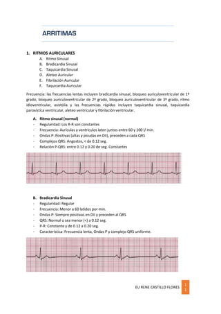 EU RENE CASTILLO FLORES
1
1
ARRITIMAS
1. RITMOS AURICULARES
A. Ritmo Sinusal
B. Bradicardia Sinusal
C. Taquicardia Sinusal
D. Aleteo Auricular
E. Fibrilación Auricular
F. Taquicardia Auricular
Frecuencia: las frecuencias lentas incluyen bradicardia sinusal, bloqueo auriculoventricular de 1º
grado, bloqueo auriculoventricular de 2º grado, bloqueo auriculoventricular de 3º grado, ritmo
idioventricular, asistolia y las frecuencias rápidas incluyen taquicardia sinusal, taquicardia
paroxística ventricular, aleteo ventricular y fibrilación ventricular.
A. Ritmo sinusal (normal)
- Regularidad: Los R-R son constantes
- Frecuencia: Aurículas y ventrículos laten juntos entre 60 y 100 l/ min.
- Ondas P: Positivas (altas y picudas en DII), preceden a cada QRS
- Complejos QRS: Angostos, < de 0.12 seg.
- Relación P-QRS: entre 0.12 y 0.20 de seg. Constantes
B. Bradicardia Sinusal
- Regularidad: Regular
- Frecuencia: Menor a 60 latidos por min.
- Ondas P: Siempre positivas en DII y preceden al QRS
- QRS: Normal o sea menor (<) a 0.12 seg.
- P-R: Constante y de 0.12 a 0.20 seg.
- Característica: Frecuencia lenta, Ondas P y complejo QRS uniforme.
 