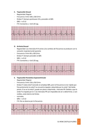 EU RENE CASTILLO FLORES
1
2
C. Taquicardia Sinusal
- Regularidad: Regular
- Frecuencia: Entre 100 y 160 l/min.
- Ondas P: Siempre positivasen DII y preceden al QRS
- QRS: < a 0.12
- P-R: Constante y < de 0.20 seg.
D. Arritmia Sinusal
- Regularidad: Los intervalos R-R varían y los cambios de frecuencia se producen con la
variación respiratoria del paciente
- Frecuencia: Entre 60 y 100 l/min.
- Ondas P: Siempre preceden al QRS
- QRS: < a 0.12
- P-R: Constante y < de 0.20 seg.
E. Taquicardia Paroxística Supraventricular
- Regularidad: Regular
- Frecuencia: Entre 150 y 250 l/min.
- Ondas P: Cada onda P precede al complejo QRS, pero la frecuencia es tan rápida que
frecuentemente la onda P se encuentra tapada o absorbida por la onda T del latido
previo. Si se ve la onda P, puede ser plana o deprimida.- Intervalo PR: Debido a que la
onda P es tapada por la T, los intervalos PR son imposibles de ver o determinar, si son
visibles, están dentro de límites
- normales.
- QRS: < a 0.12
- P-R: No se observa por la frecuencia
 
