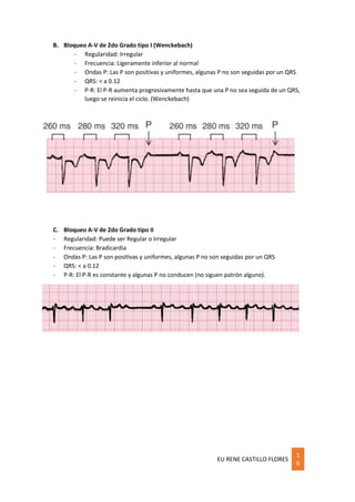 EU RENE CASTILLO FLORES
1
6
B. Bloqueo A-V de 2do Grado tipo I (Wenckebach)
- Regularidad: Irregular
- Frecuencia: Ligeramente inferior al normal
- Ondas P: Las P son positivas y uniformes, algunas P no son seguidas por un QRS
- QRS: < a 0.12
- P-R: El P-R aumenta progresivamente hasta que una P no sea seguida de un QRS,
luego se reinicia el ciclo. (Wenckebach)
C. Bloqueo A-V de 2do Grado tipo II
- Regularidad: Puede ser Regular o Irregular
- Frecuencia: Bradicardia
- Ondas P: Las P son positivas y uniformes, algunas P no son seguidas por un QRS
- QRS: < a 0.12
- P-R: El P-R es constante y algunas P no conducen (no siguen patrón alguno).
 