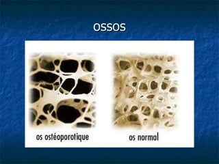 ossos 
