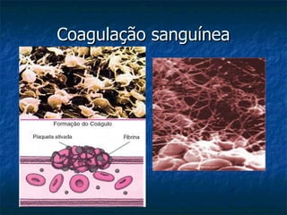 Coagulação sanguínea 