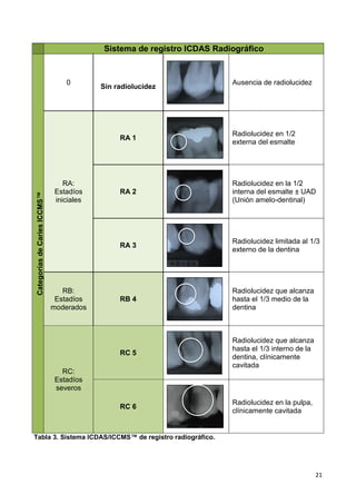 21
Sistema de registro ICDAS Radiográfico
Categorías
de
Caries
ICCMS™
0
Sin radiolucidez
Ausencia de radiolucidez
RA:
Estadíos
iniciales
RA 1
Radiolucidez en 1/2
externa del esmalte
RA 2
Radiolucidez en la 1/2
interna del esmalte ± UAD
(Unión amelo-dentinal)
RA 3
Radiolucidez limitada al 1/3
externo de la dentina
RB:
Estadíos
moderados
RB 4
Radiolucidez que alcanza
hasta el 1/3 medio de la
dentina
RC:
Estadíos
severos
RC 5
Radiolucidez que alcanza
hasta el 1/3 interno de la
dentina, clínicamente
cavitada
RC 6
Radiolucidez en la pulpa,
clínicamente cavitada
Tabla 3. Sistema ICDAS/ICCMS™ de registro radiográfico.
 