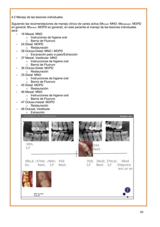83
4.2 Manejo de las lesiones individuales
Siguiendo las recomendaciones de manejo clínico de caries activa (MInicial: MNO; MModerado: MOPD
en general; MSevera: MOPD en general), en este paciente el manejo de las lesiones individuales
será:
- 16 Mesial: MNO
o Instruciones de higiene oral
o Barniz de Fluoruro
- 24 Distal: MOPD
o Restauración
- 38 Ocluso-Distal: MNO / MOPD
o Excavación paso a paso/Extracción
- 37 Mesial, Vestibular: MNO
o Instrucciones de higiene oral
o Barniz de Fluoruro
- 36 Ocluso-Distal: MOPD
o Restauración
- 35 Distal: MNO
o Instrucciones de higiene oral
o Barniz de Fluoruro
- 45 Distal: MOPD
o Restauración
- 46 Mesial: MNO
o Instrucciones de higiene oral
o Barniz de Fluoruro
- 47 Ocluso-mesial: MOPD
o Restauración
- 48 Oclusal, Vestibular
o Extracción
 