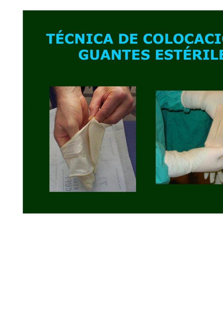 GUANTES EN CIRUGIA. DISTINTOS TIPOS DE GUANTES USOS
