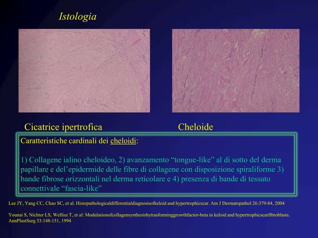 Guarigione delle ferite e sua patologia | PPTX | Death, Injury, or ...