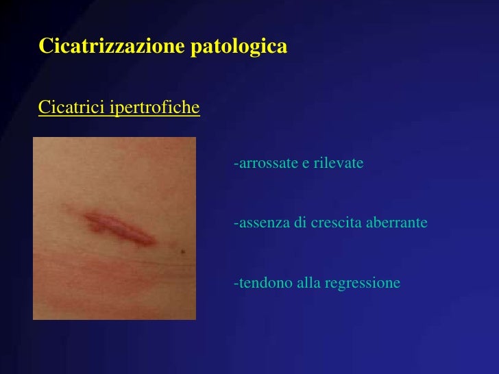 Guarigione delle ferite e sua patologia