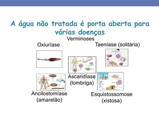 A água não tratada é porta aberta para
várias doenças
Verminoses
Taeníase (solitária)
Esquistossomose
(xistosa)
Ancilostomíase
(amarelão)
Oxiuríase
Ascaridíase
(lombriga)
 