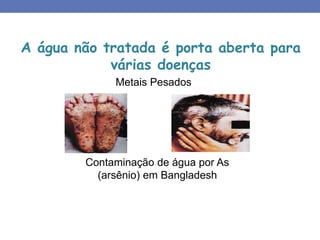 A água não tratada é porta aberta para
várias doenças
Metais Pesados
Contaminação de água por As
(arsênio) em Bangladesh
 