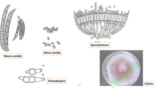 DKC
Macro conidia
Micro conidia
Sporodochium
Clamydospore
Colony
Devendra
 