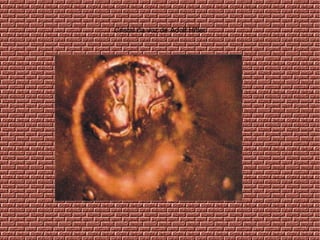 Cristal da voz de Adolf Hitler
 