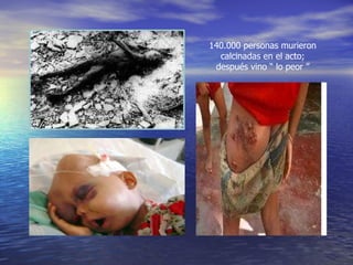 140.000 personas murieron calcinadas en el acto; después vino “ lo peor ” 