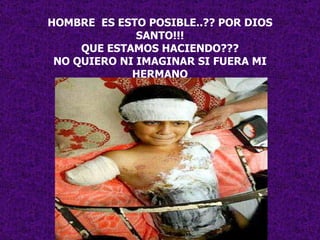 HOMBRE  ES ESTO POSIBLE..?? POR DIOS SANTO!!! QUE ESTAMOS HACIENDO??? NO QUIERO NI IMAGINAR SI FUERA MI HERMANO 