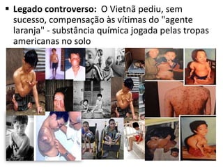  Legado controverso: O Vietnã pediu, sem
sucesso, compensação às vítimas do "agente
laranja" - substância química jogada pelas tropas
americanas no solo
 
