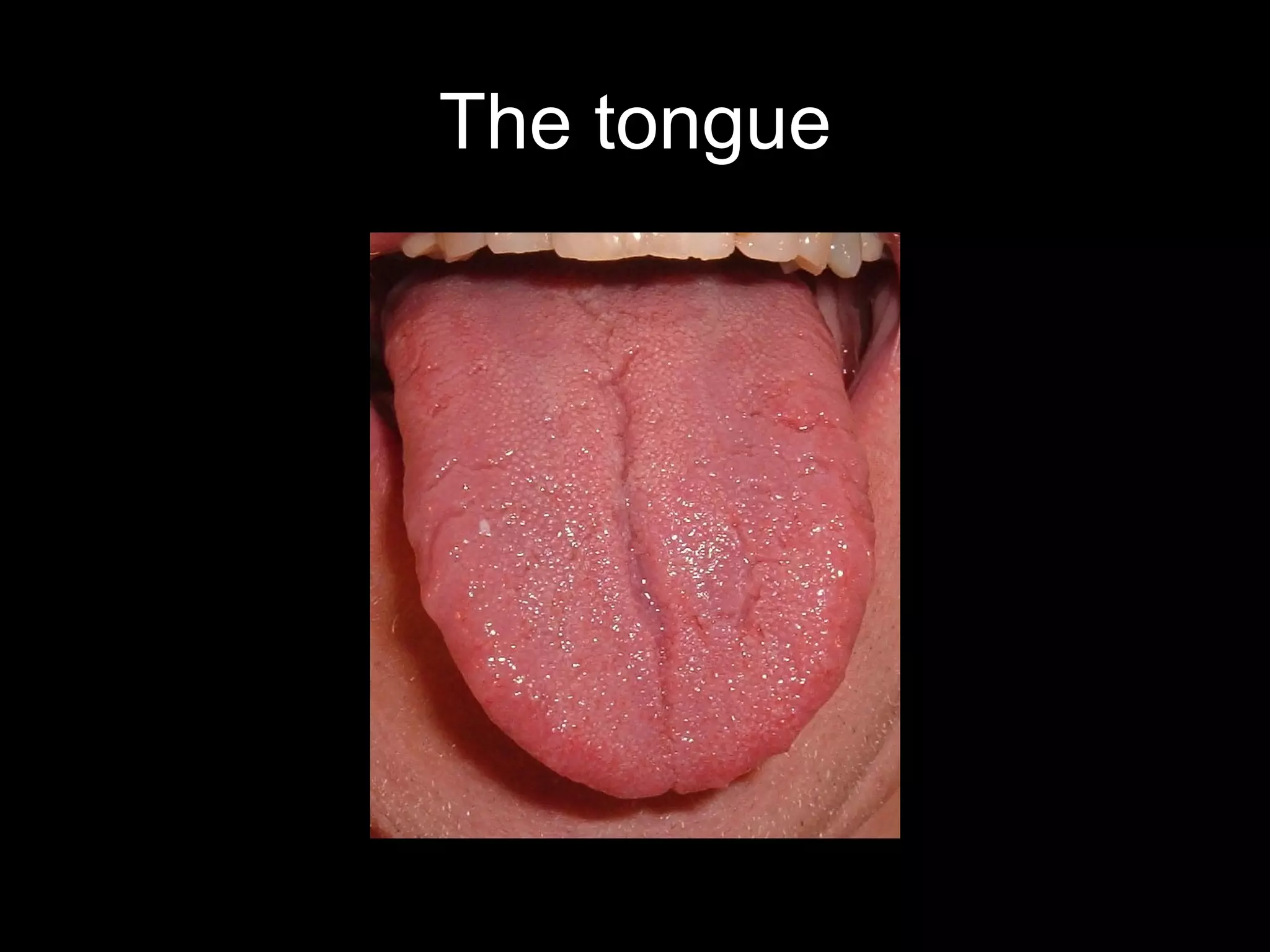 The tongue
 