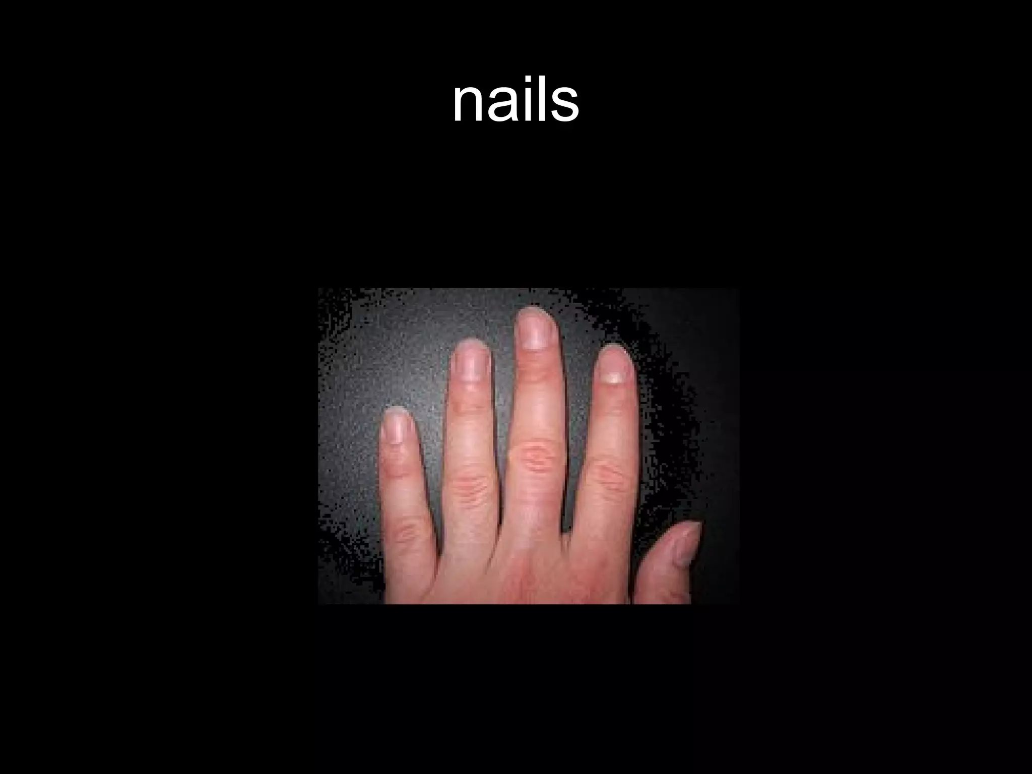 nails
 