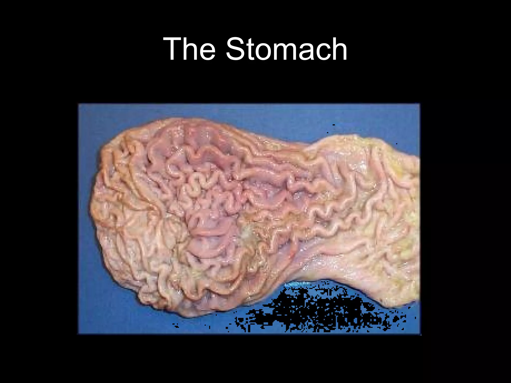 The Stomach
 