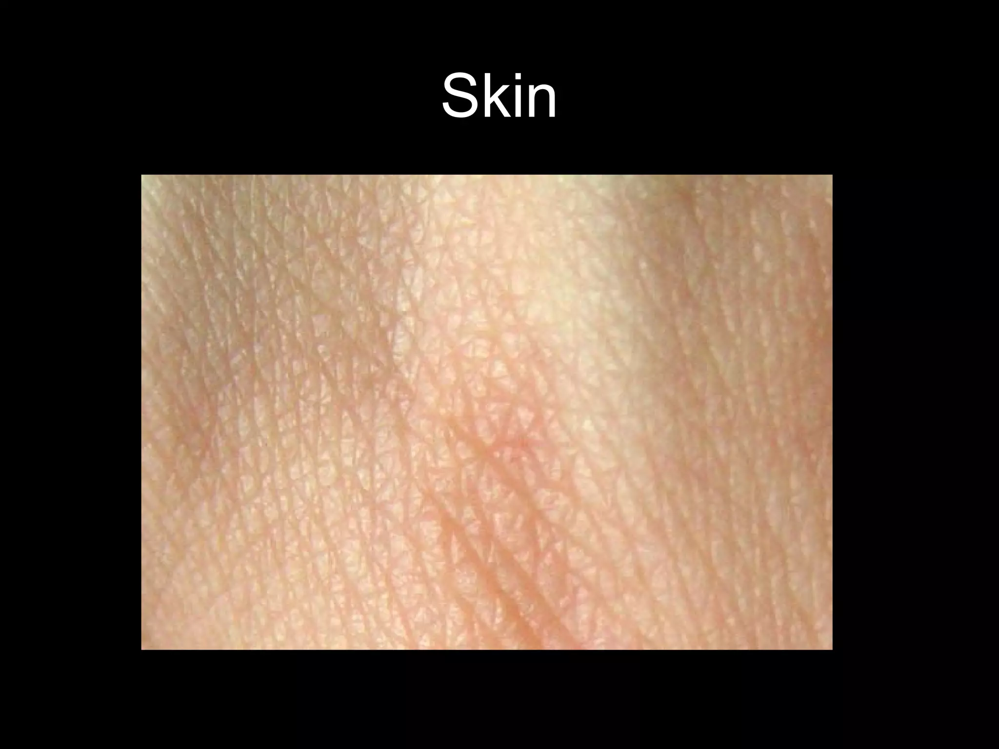 Skin
 