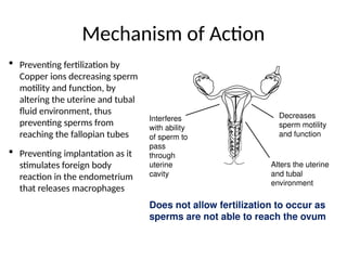Mechanism of Action
 Preventing fertilization by
Copper ions decreasing sperm
motility and function, by
altering the uterine and tubal
fluid environment, thus
preventing sperms from
reaching the fallopian tubes
 Preventing implantation as it
stimulates foreign body
reaction in the endometrium
that releases macrophages
Decreases
sperm motility
and function
Interferes
with ability
of sperm to
pass
through
uterine
cavity
Alters the uterine
and tubal
environment
Does not allow fertilization to occur as
sperms are not able to reach the ovum
 