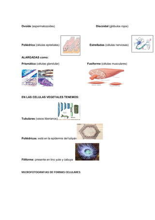 Ovoide (espermatozoides) Discoidal (glóbulos rojos)
Poliédrica (células epiteliales) Estrelladas (células nerviosas)
ALARGADAS como:
Prismática (células glandular) Fusiforme (células musculares)
EN LAS CELULAS VEGETALES TENEMOS:
Tubulares (vasos liberianos)
Poliédricas: está en la epidermis del tulipán
Filiforme: presente en lino yute y cabuya
MICROFOTOGRAFIAS DE FORMAS CELULARES
 